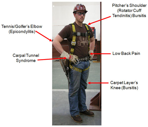 WMSDs are occupational disorders of the soft tissues such as