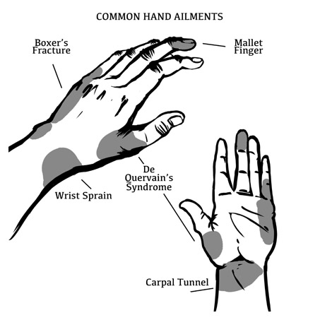 Illustration of common hand ailments (Boxer's Fracture, Mallet Finger, De Quervain's Syndrome, Wrist Sprain, Carpal Tunnel)